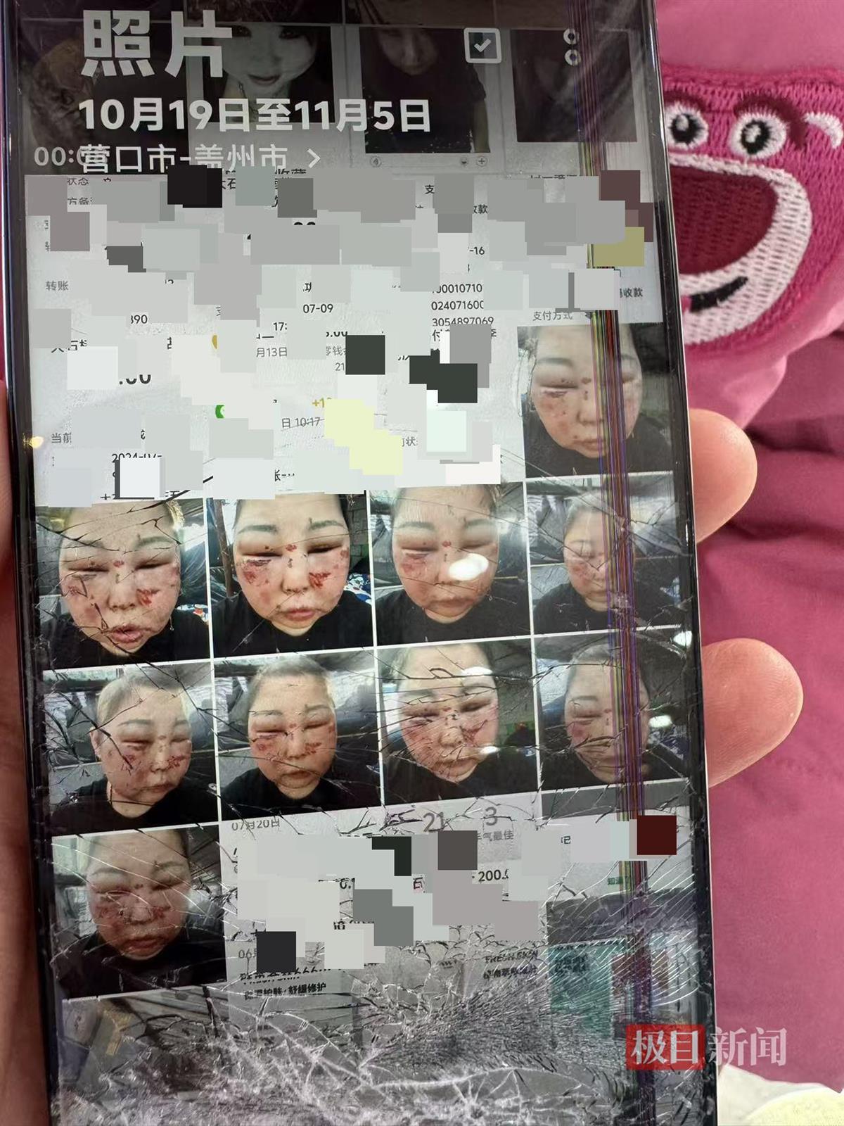 被前夫打进ICU的女子情况仍不稳定，其8岁女儿也曾遭父亲扇脸，律师：已构成故意伤害罪，或同时涉虐待罪